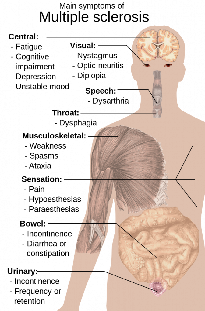 800px-Symptoms_of_multiple_sclerosis.svg