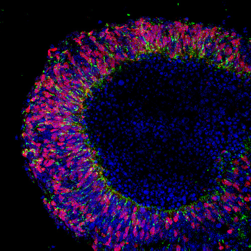 A newly formed retina developed through the use of embryonic stem cells. Credit to UCL News, CC BY-NC 2.0 - https://www.flickr.com/photos/uclnews/9359421958/in/photolist-fg4u57-akiAut-6yYVAK-dopZd2-9oEDk6-do9QH1-ffPBPT-9nDQNr-akiAA6-afoYQM-akiADg-ffPdQa-6aBV8G-akiw4T-7tBfF7-6axKAn-624kA8-dp66gL-6axKzi-6axKzv-6aBVaL-6aBV91-aRfkZ2-akiABD-pbGUs6-9NSJxc-piufUg-8iDKSv-672xHL-8pDjqK-9nGTq5-dp5WEz-dpYKfJ-dp67kB-dLmSQt-4ujNjZ-afrJn1-afoUVK-afrA6W-afoXjt-afrFts-afp7iV-afp4zx-afrPUA-afp248-afp5K8-afrSCu-afrCpN-afrGjs-afryp5