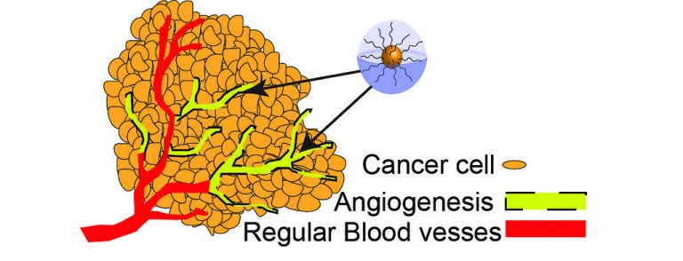 Angiogenesis And The Tumour Growth – BIOL312 @UNBC – Molecular Cell ...