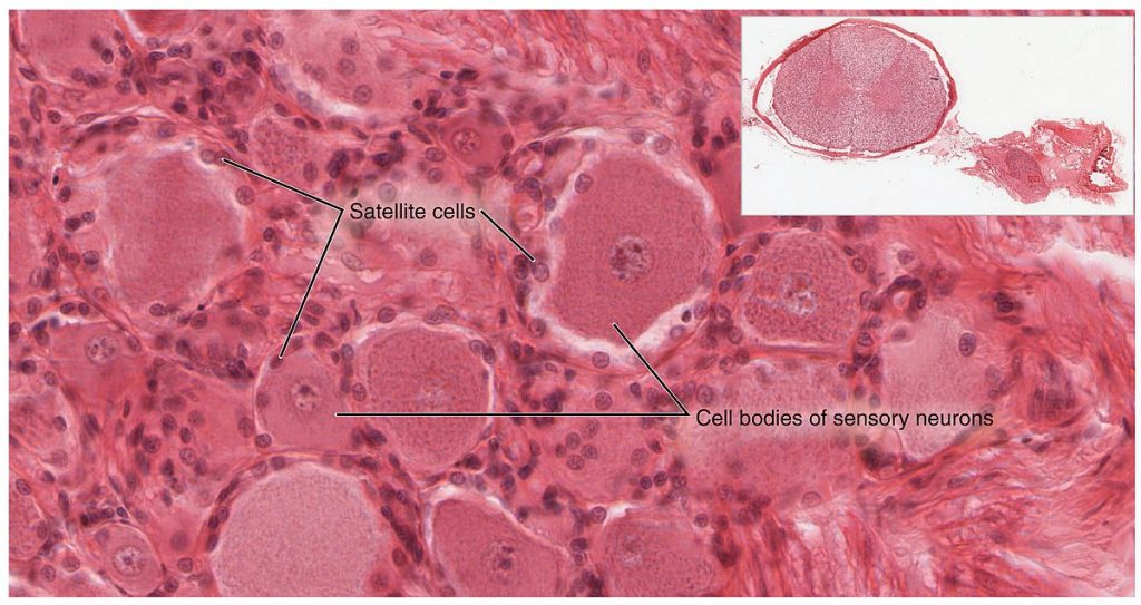Skeletal muscle tissue containing satellite cells. Image credit: OpenStax, CC BY 4.0