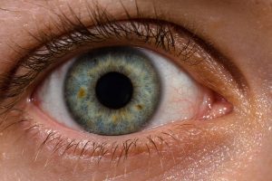 Uveal Melanoma: A Terrifying Threat to Your Vision and Potentially Your ...